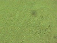 Pd Gyne 3-09 Sperma x 40.jpg